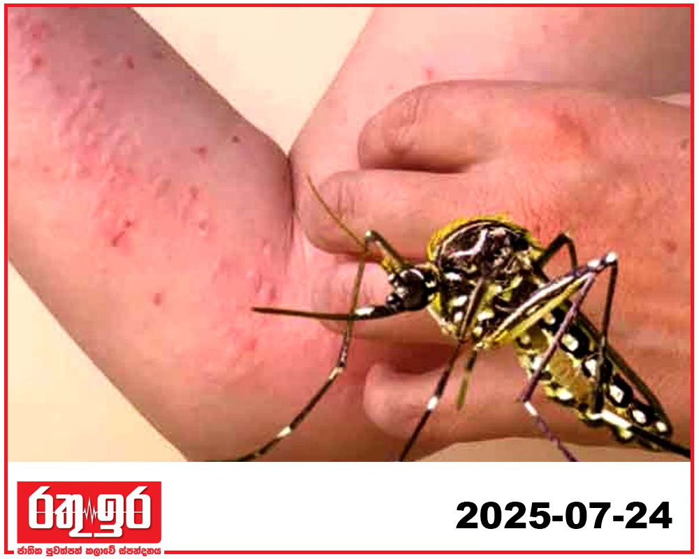 ඉන්දියාවට වසංගතයක් වූ චිකුන් ගුන්‍යා ලොව පුරා පැතිරෙයි ද?